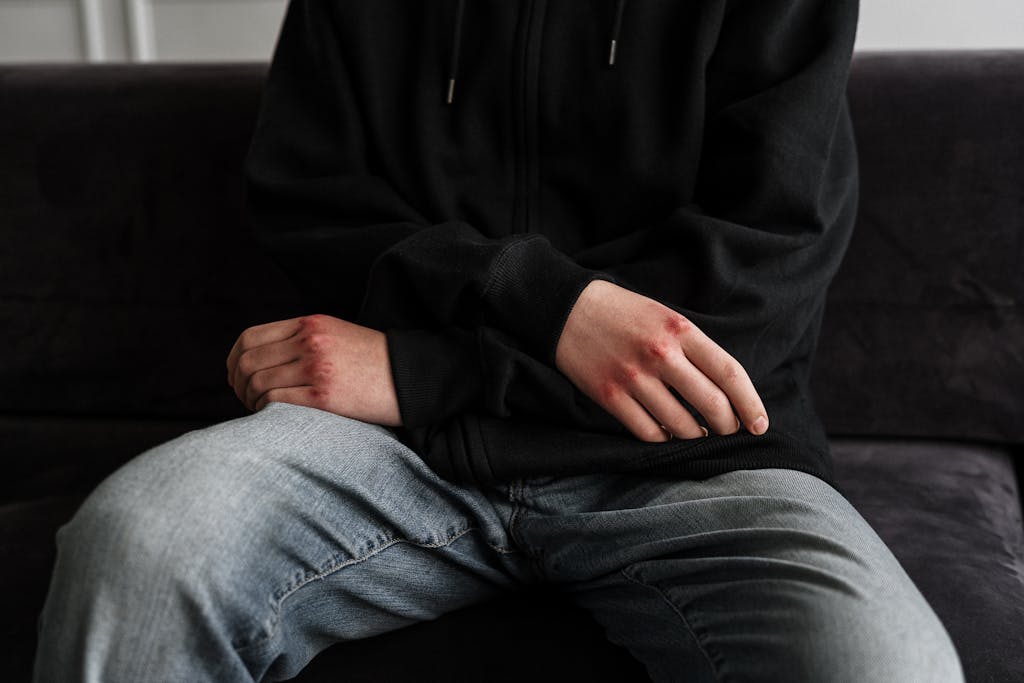 A teenager with bruised knuckles